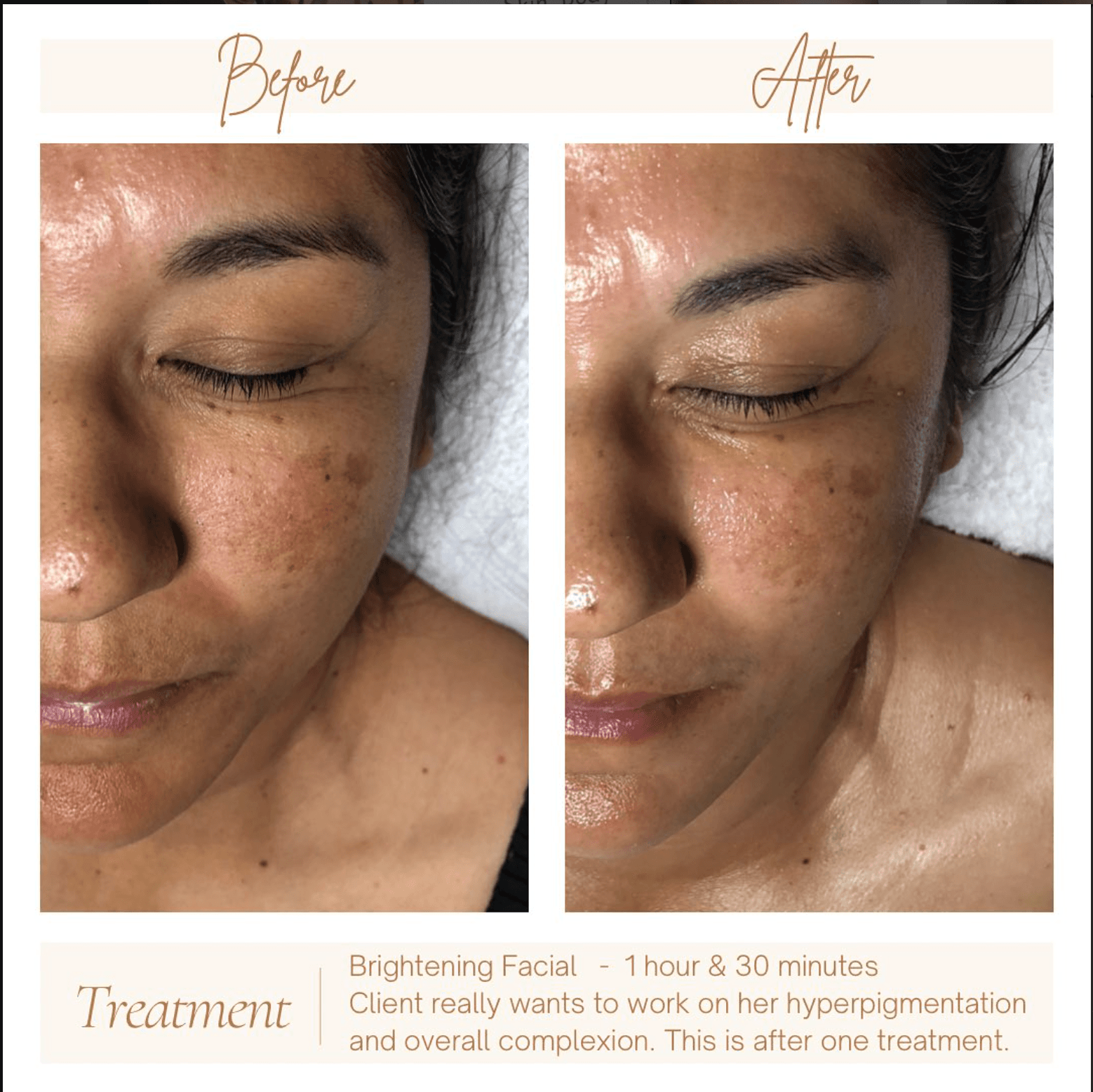 The SkinFit Studio Instagram post 7