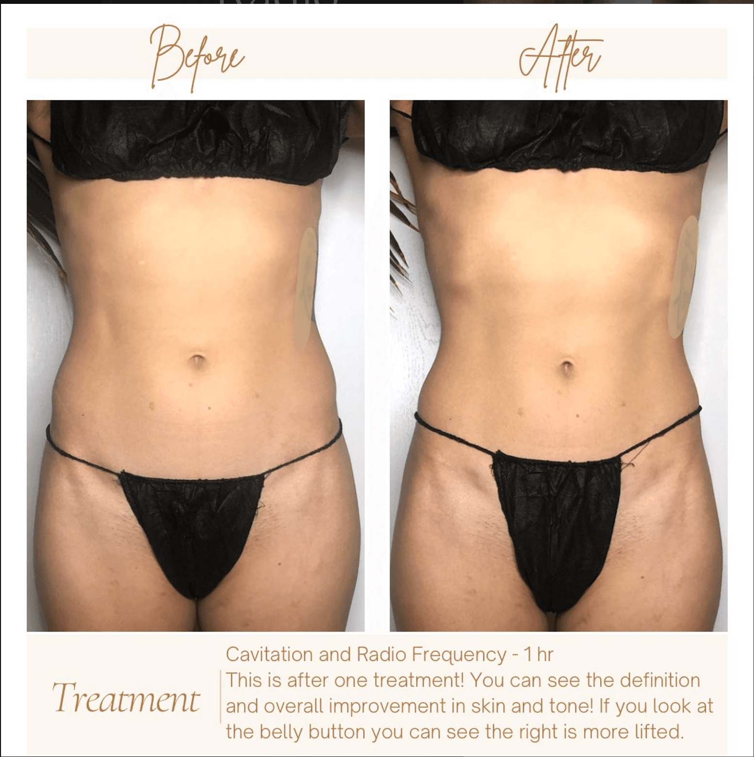 The SkinFit Studio Instagram post 8